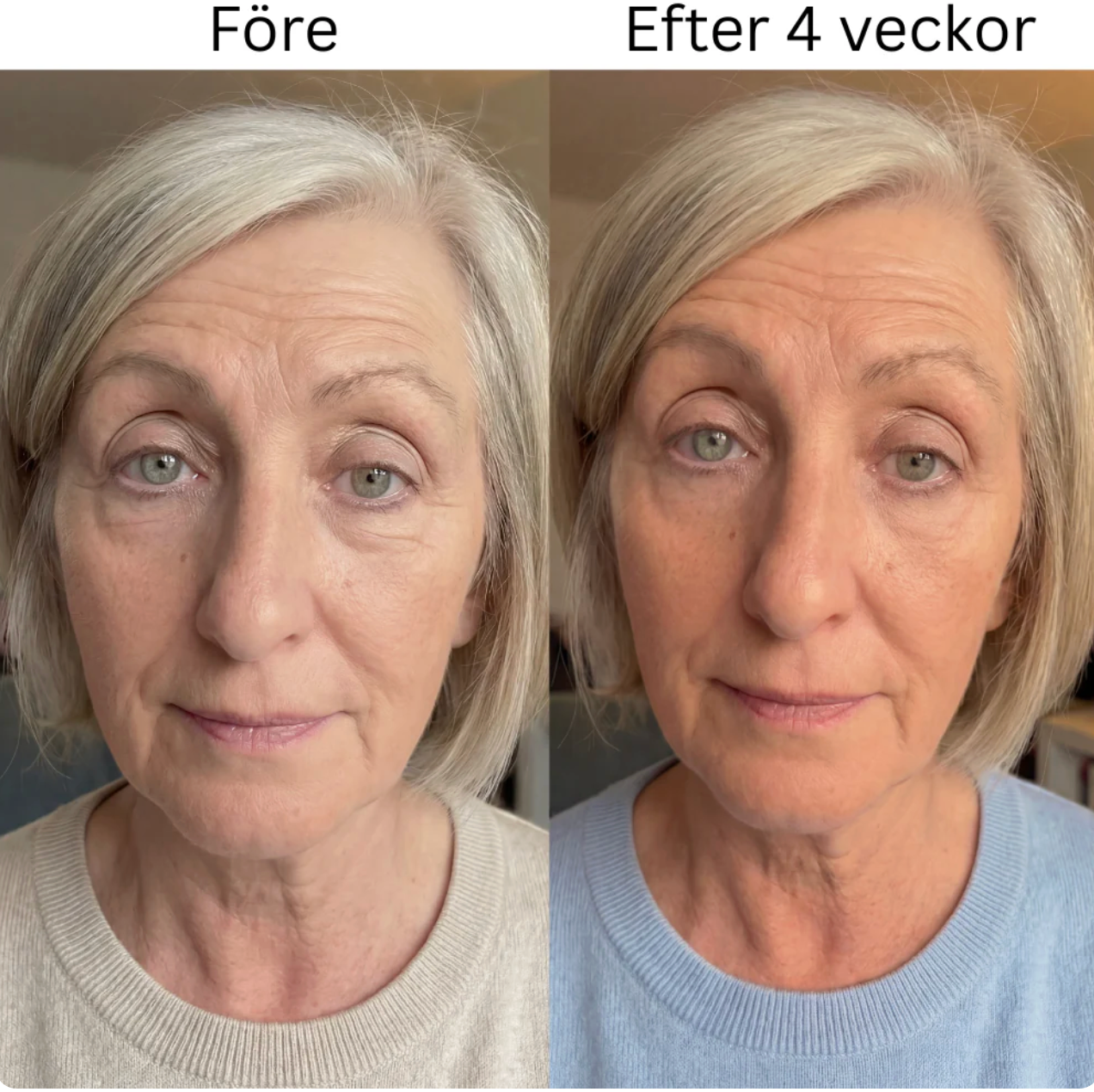 PeptaEye - Collagen Hydrogel Eye Patch