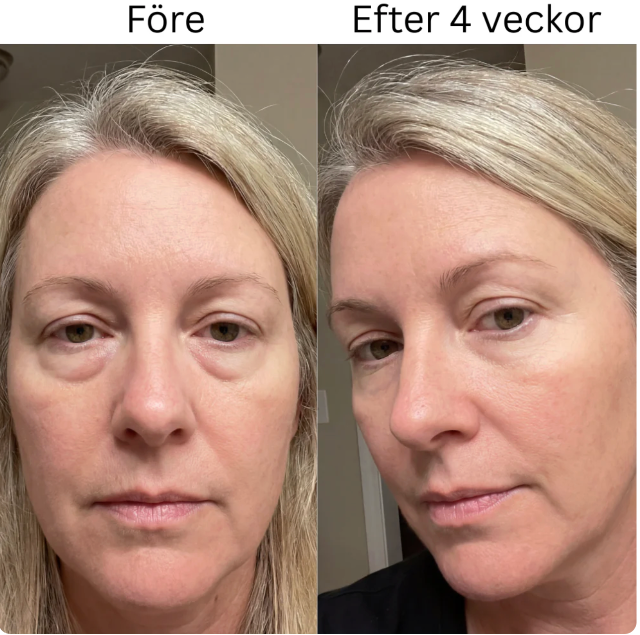 PeptaEye - Collagen Hydrogel Eye Patch